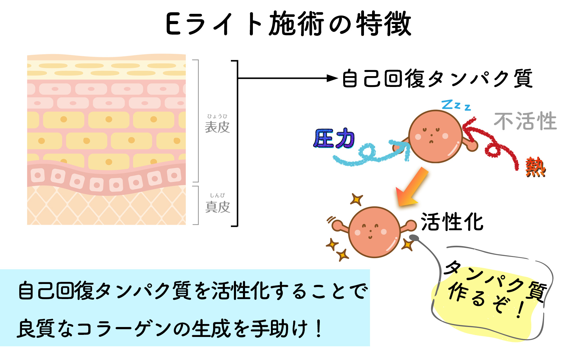 Eライトの特徴