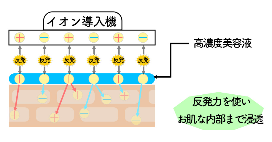 イオン導入仕組み